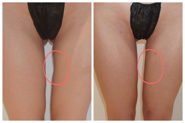 Image may contain Body Part Knee Person Thigh and Skin